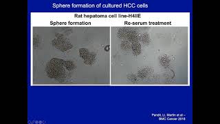 06.11.2021, ""Challenges/Advances in Hepatocellular & Pancreatic Surgical  Cancer Research""
