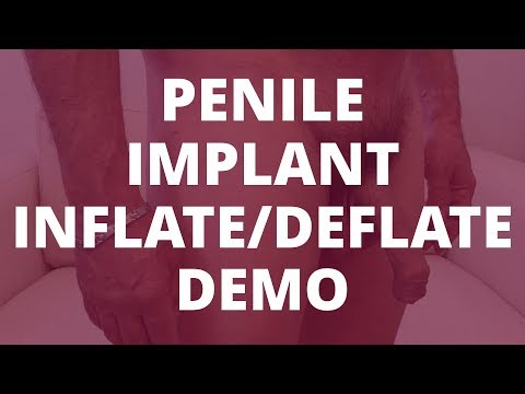 Penile Implant Demo (inflate/deflate) - 6 Months Post-Op