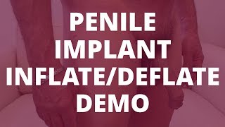 Penile Implant Demo (inflate/deflate) - 6 Months Post-Op