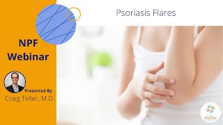 Psoriasis Flares