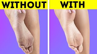 AWESOME FEET HACKS AND SHOE DIY CRAFTS FOR ANY SITUATION