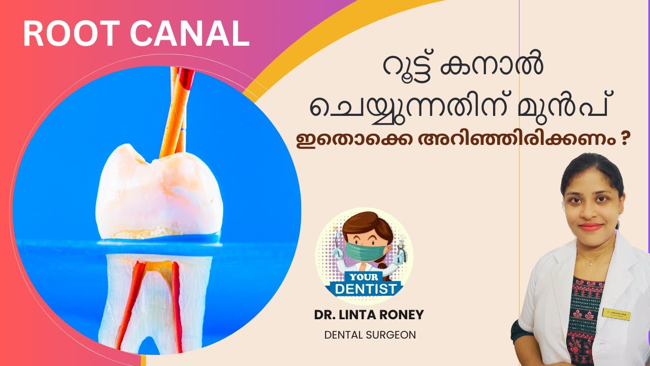 റൂട്ട് കാനൽ ചെയ്യുന്നതിന് മുൻപ് ഇതൊക്കെ അറിഞ്ഞിരിക്കണം Root Canal