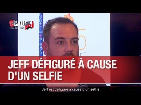 Jeff est défiguré à cause d'un selfie - C’Cauet sur NRJ