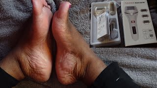 Astamon Electric Foot File Review