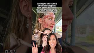 The Real Reason Your Cyst Wont Go Away