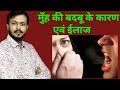 मुँह की बदबू के कारण एवं उपाए | permanent treatment of mouth smell | #myvj