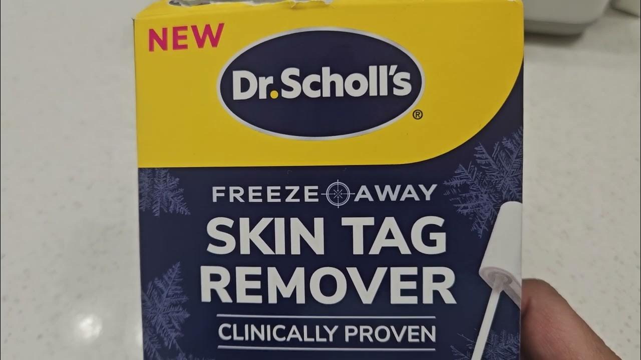 Review of Dr. Scholls skin tag remover kit..big NO for me - YouTube - Doctor Scholl's Skin Tag Remover Reviews
