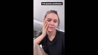 Talia Mar On Her New Lips