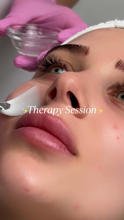 Give the glow your skin deserves ✨️| Skinaa Clinic  #viral