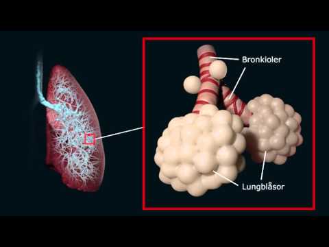 Video: Echinokockos I Lungorna - Orsaker, Symtom Och Diagnos Av Echinokockos I Lungorna