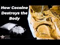 Why Cocaine Is So Incredibly Dangerous