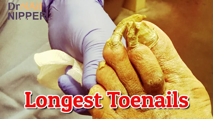 Have you seen Long Toenails? These are the longest...