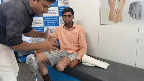 Nakali taang -Part 1 - short below knee stump prosthesis- velocity foot from CPI - Agra UP