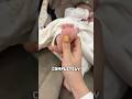 Babinski Reflex: A Secret Warning Sign?! 🤔🦶