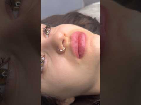 Объемные губы это сразу и красота и молодость #косметологростов #контурнаяпластика #фулфейс #губы