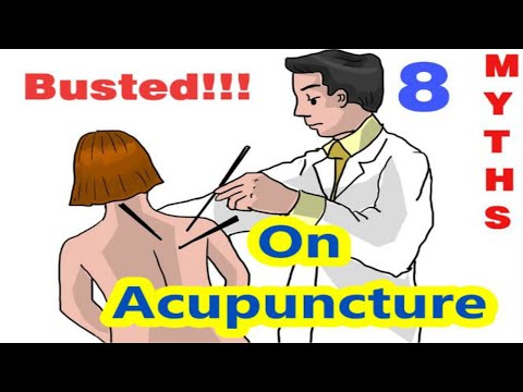 Video: 8 Myths About Acupuncture