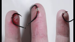 Putting Fishhooks Through My Fingers