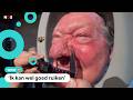 Hans heeft de grootste neus ter wereld