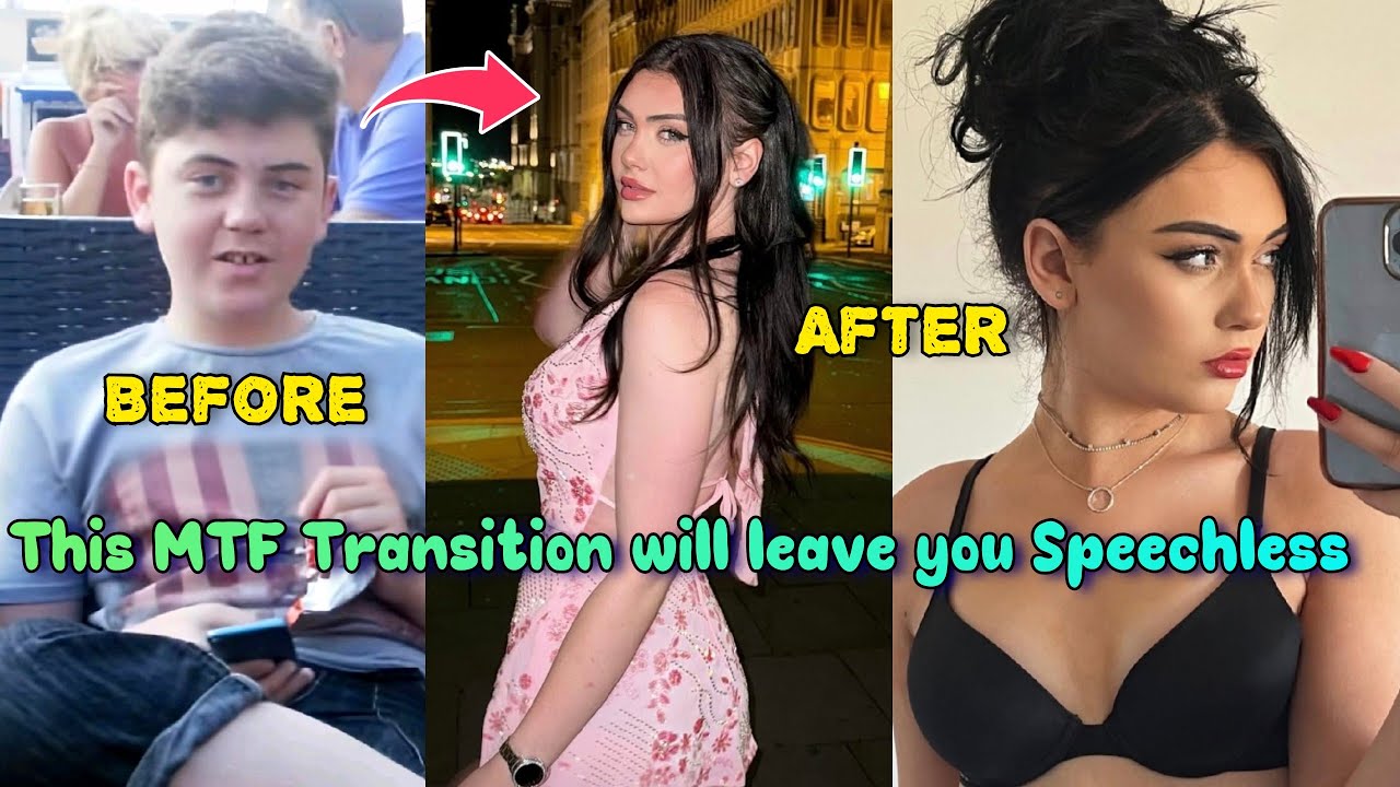 Её трансгендерный переход в 18 лет изменил её жизнь | Переход из мужчины в женщину | Переход из м...