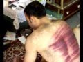 A Young Man Of Kiashahr Who Whipped In Islamic Republic Of Iran 