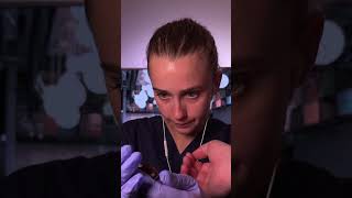 Test allergique sur le bras