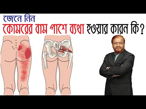 ভিডিও: অতিরিক্ত পেলভিস কি?