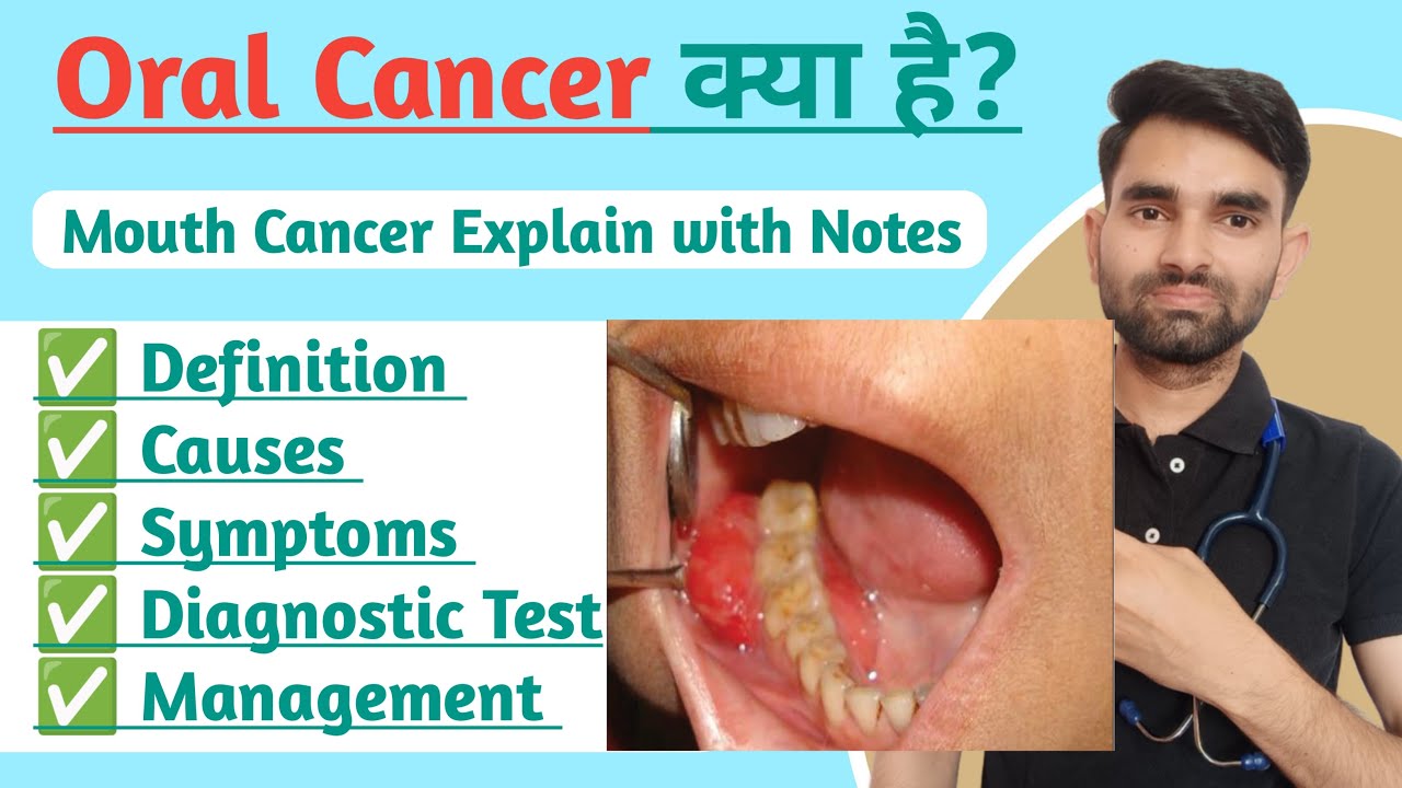 Oral Cancer Lecture in Hindi Mouth Cancer kaise hota hai Oncology