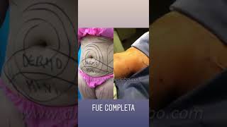 Dr. Gabriel Lobo, Cirujano Plástico.