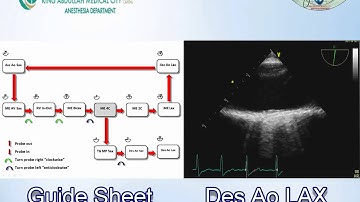 096 Guide Sheet for Basic TEE examination KAMC