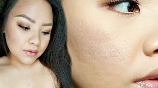 How to MINIMIZE INDENTED ACNE SCARS with Makeup ♡ Cynthia Hang