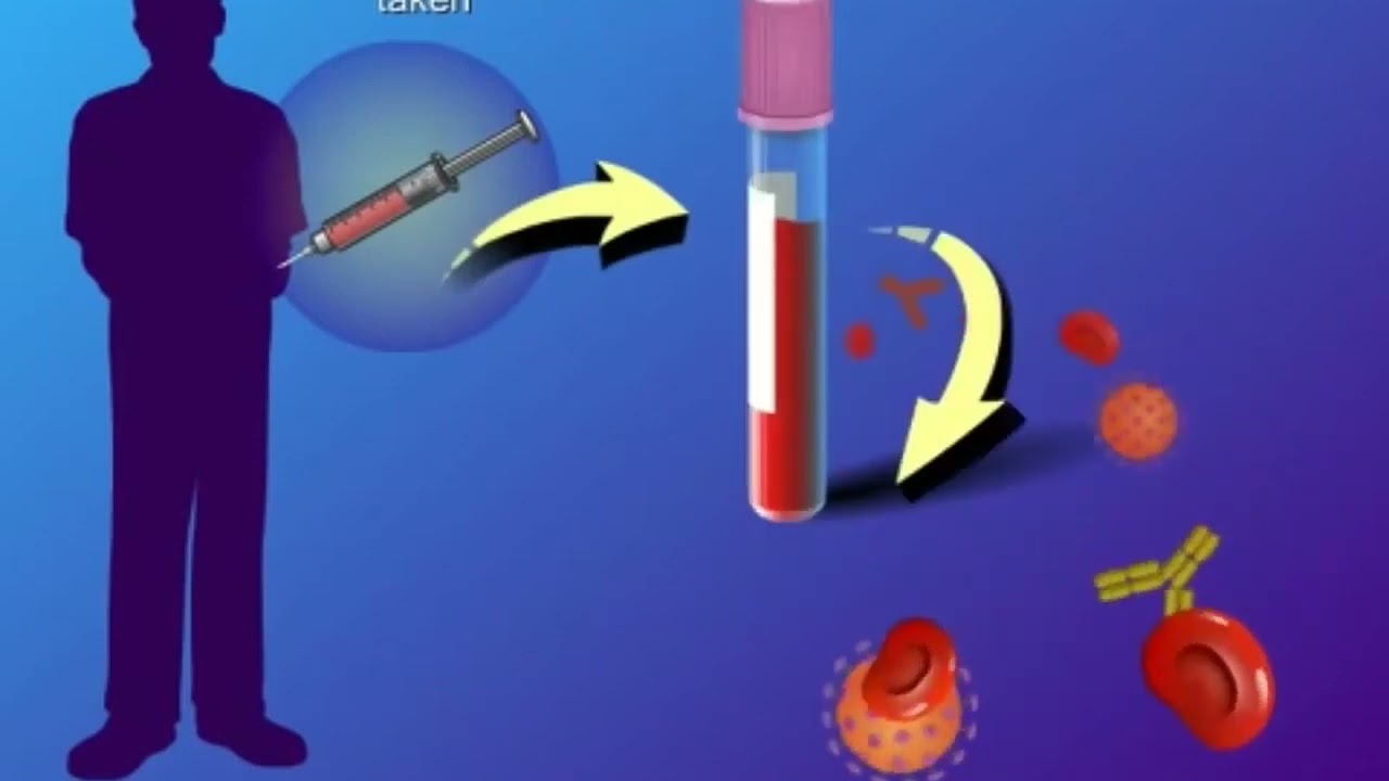 kie-hiv-aids-dan-ims-youtube