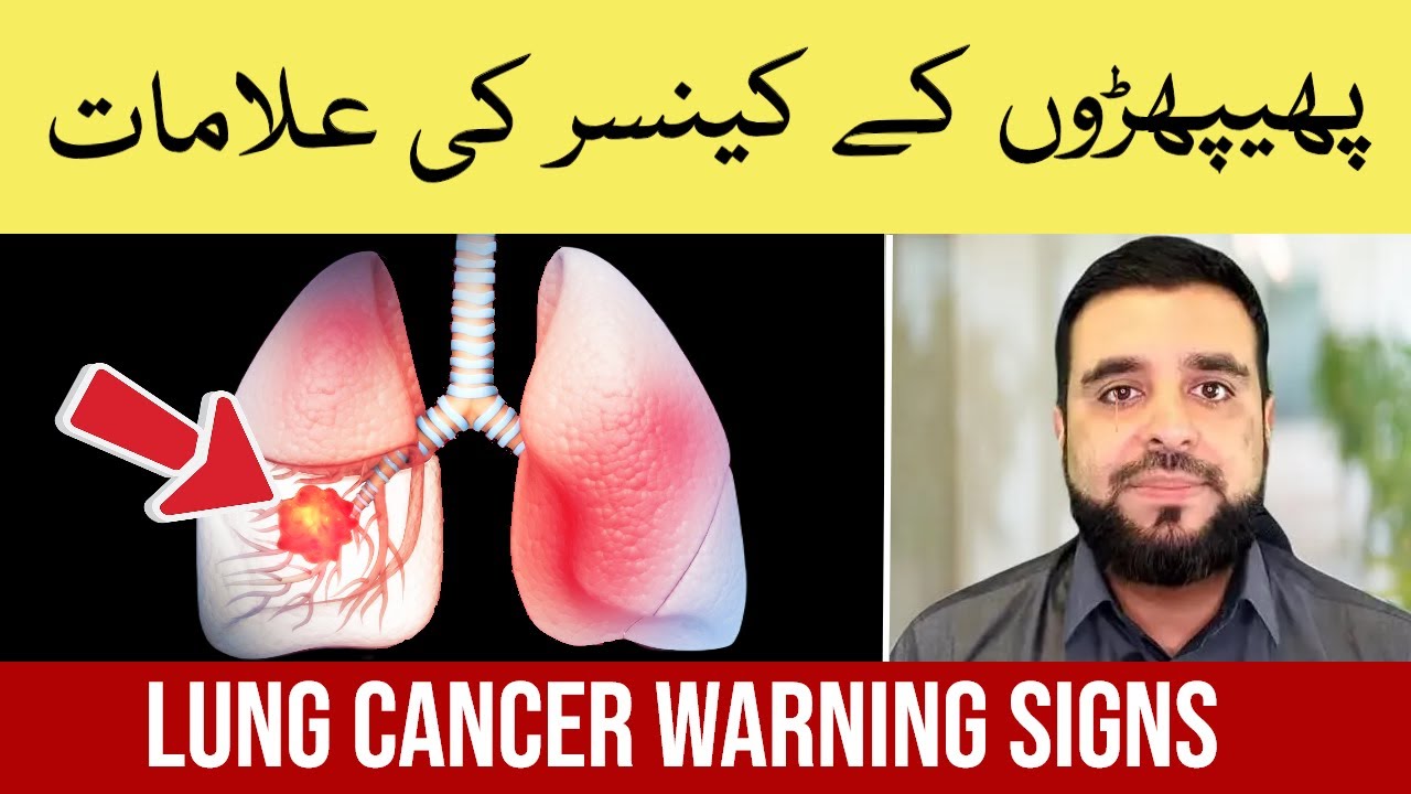 lung-cancer-symptoms-explained-how-to-treat-lung-cancer-phephron-ka