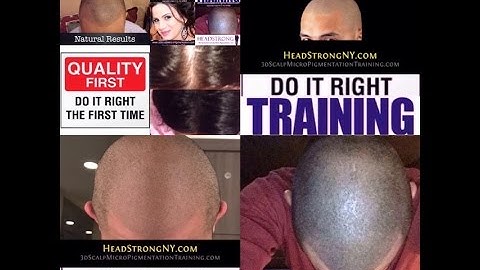 HeadStrong NY - NYC 3dScalpMicropigmentation.com - Ryan w/Chris