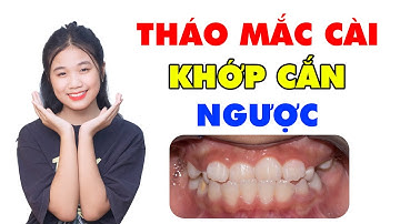 Cảm Xúc Sau Khi Tháo Mắc Cài Niềng Răng Chữa Khớp Cắn Ngược Của Mai Trang | Bác sĩ Thu Gia Lâm