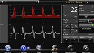 bellavista™ Ventilators: ATC instructional video DE