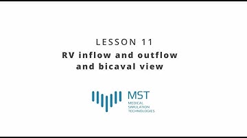 MST Masterclass - Lesson 11 - RV inflow and outflow and bicaval view
