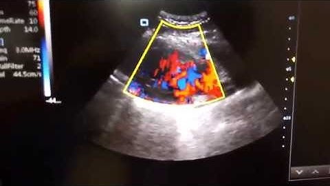 Cardiac Probe color doppler MSLCU25 video/Protable touch screen color doppler USG