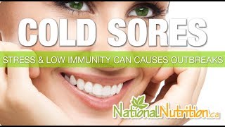 Cold Sores Due To Herpes Simplex Virus - Treatment For Cold Sore | Natural Health Review Canada