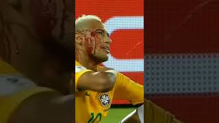 Neymar injury ? #shorts #shortsfifaworldcup