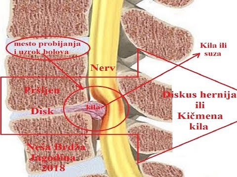 Visok pritisak i istezanje u obrnutom položaju