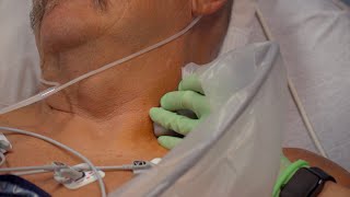 Interscalene Nerve Blocks: Shoulder surgery anesthesia at the Total Joint Center screenshot 4