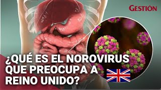 NOROVIRUS: ¿qué es y cómo se contagia el virus que prolifera en Reino Unido?