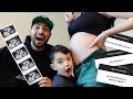 2O WEEK PREGNANCY UPDATE l ANATOMY ULTRASOUND RESULTS