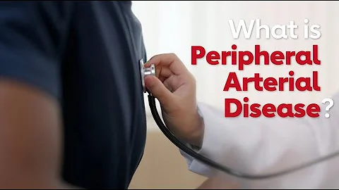 PAD: Get the facts on peripheral artery disease