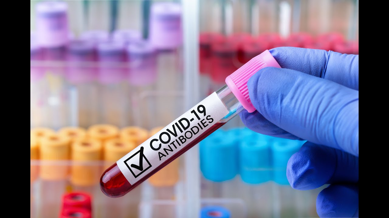 IgM And IgG Antibodies Represent Different Stages Of An Immune Response IgM And IgG Antibodies Represent Different Stages Of An Immune Response