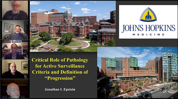 Webinar: Active Surveillance & Beyond - Dr. Jonath...