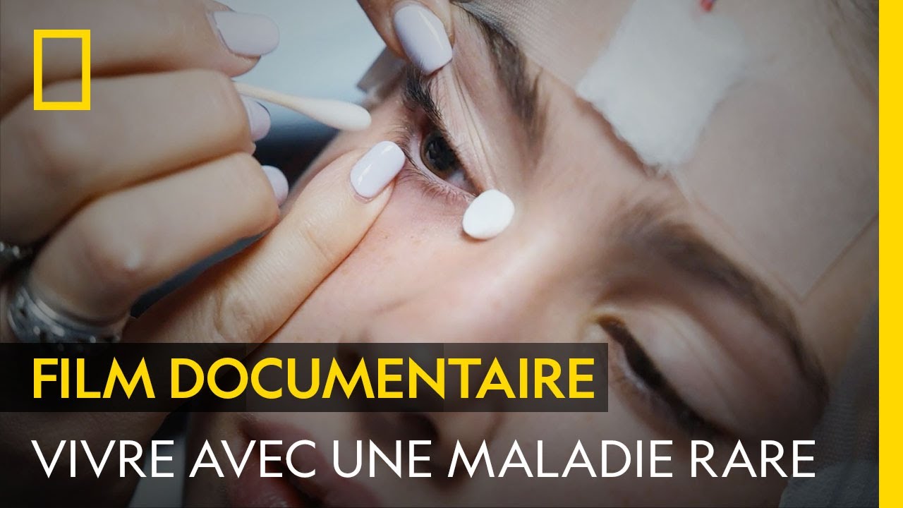 Maladie génétique rare : le diagnostic qui change tout