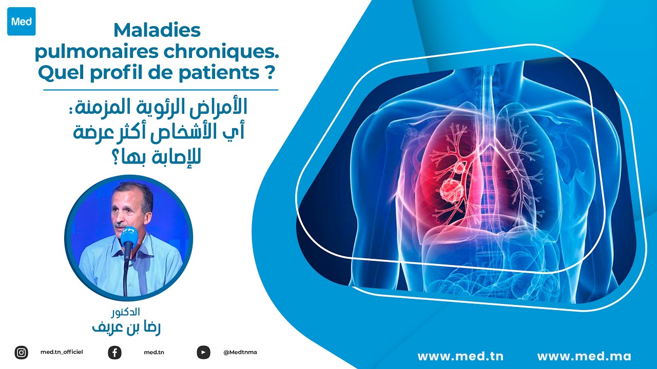 Dr Ridha Ben Arif - الأمراض الرئوية المزمنة: أي الأشخاص أكثر عرضة للإصابة بها؟