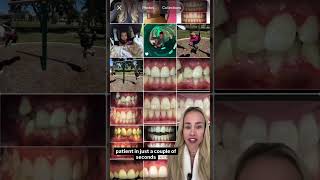 queenofinvisalign puts her stamp of approval on the Smileviz simulation software for ortho, veneer,