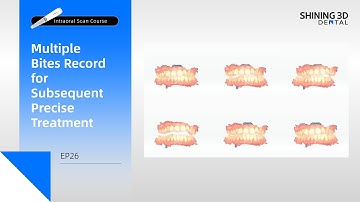 Intraoral Scan Course EP26｜Multiple Bites Record for Subsequent Precise Treatment